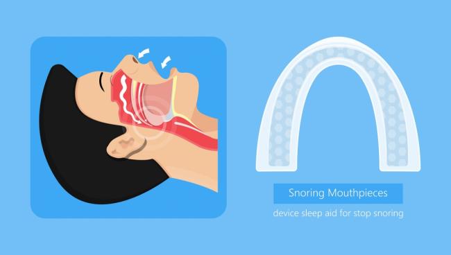 Could A Mouth Guard Be A Good Alternative To CPAP? Service