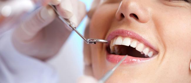 Professional Dental Cleaning Service