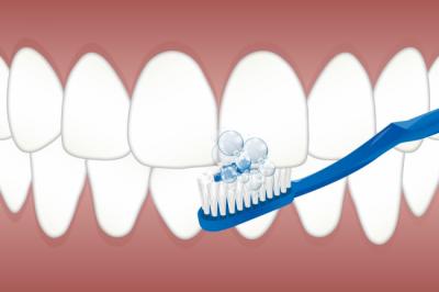 Preparing for a Professional Dental Cleaning